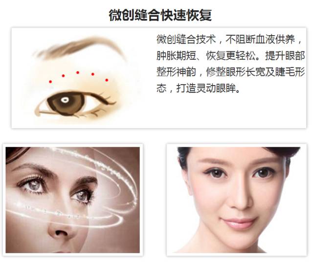 上海双眼皮整形哪家医院好