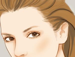 发际线移植的特点有哪些