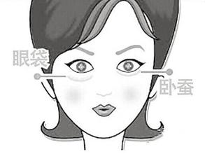 上海美莱去除眼袋有什么优势