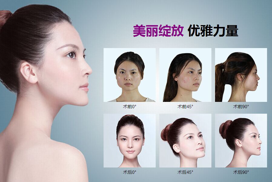 梅花香自苦寒来——刘俊梅美莱蜕变记