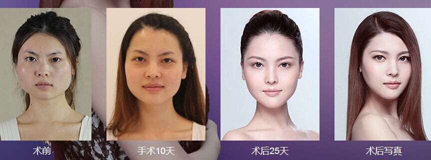 梅花香自苦寒来——刘俊梅美莱蜕变记