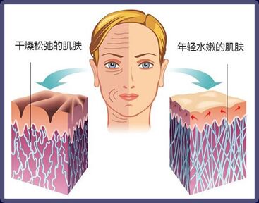 正版除皱的那些事？<a href='/' target='_blank'><u>上海美莱</u></a>揭开神秘面纱