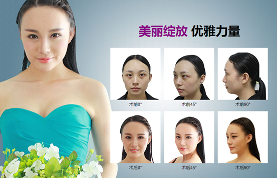 <a href='/' target='_blank'><u>上海美莱</u></a>整形怎么样