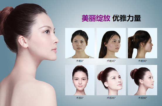 上海美莱整形怎么样