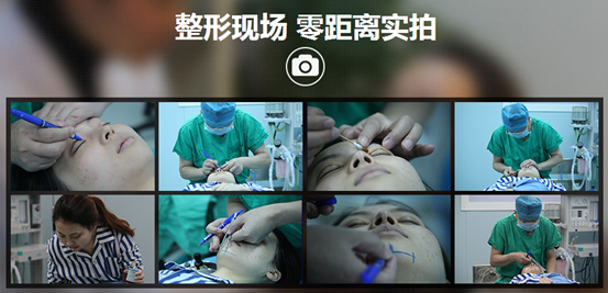 上海美莱整形怎么样