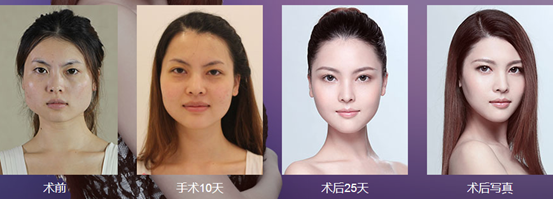 上海美莱整形怎么样