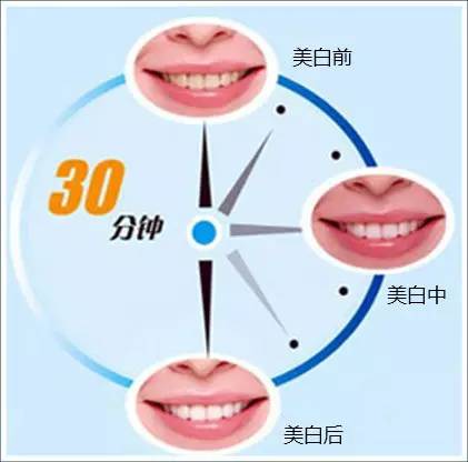 上海做牙齿矫正哪里好