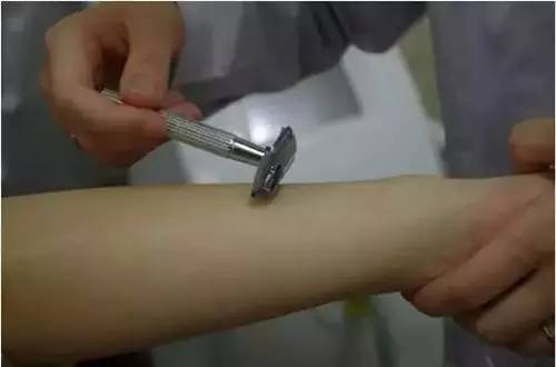 上海冰点脱毛医院哪家好