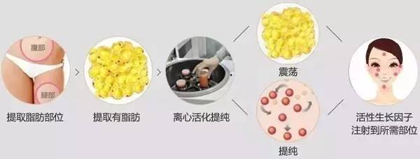 丰胸有什么好方法