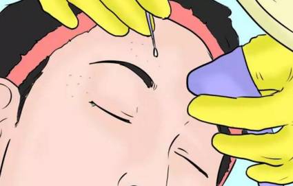 上海祛痘哪家医院好