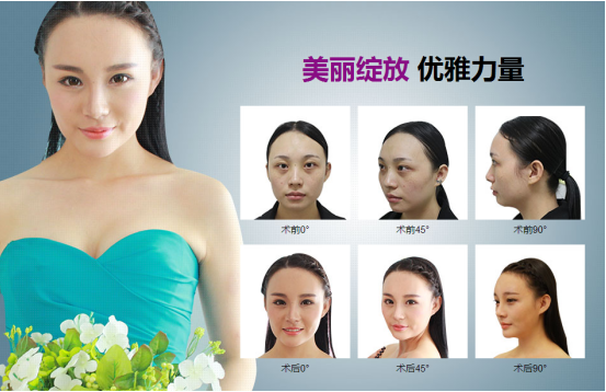 许言美莱蜕变记，活出自己的样子