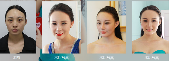 许言美莱蜕变记，活出自己的样子