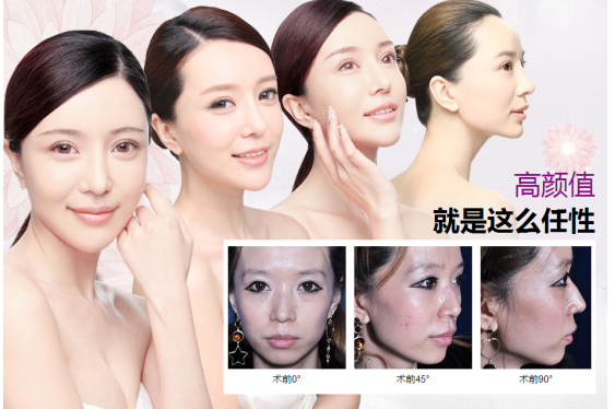 张雪儿美莱蜕变记，我要闪耀不平凡