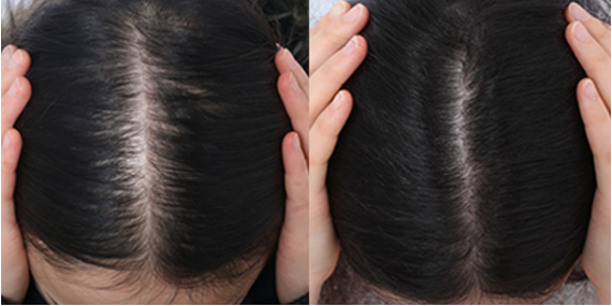 上海植发整形医院那个