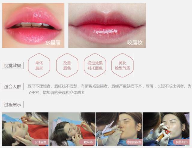 上海半纹绣哪家医院好