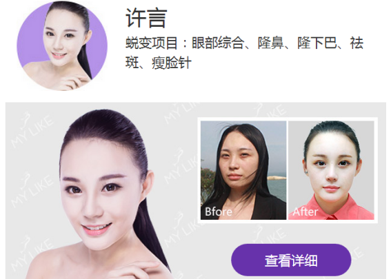 上海美莱三月颜值盛宴，女王“价”到