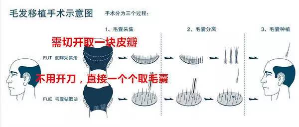 上海哪家医院做种植发有效
