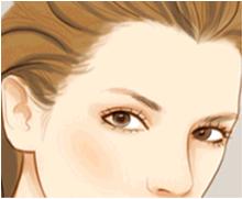 上海美莱种植美人尖