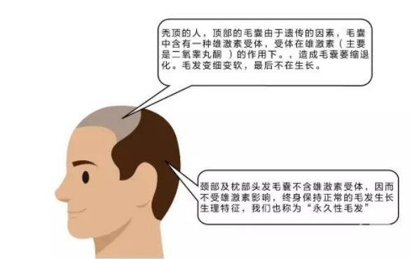 上海美莱植发的过程