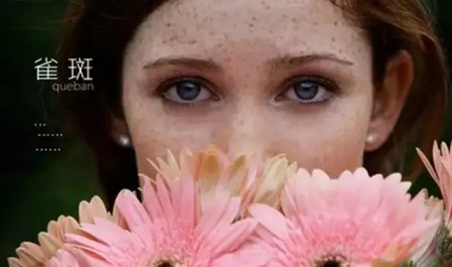 上海美莱激光去雀斑