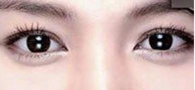 上海美莱注射丰卧蚕