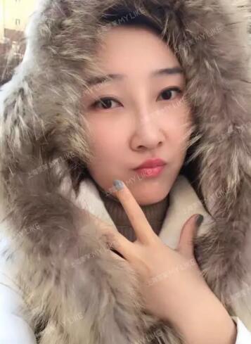 上海美莱真人鼻修复案例，秀妍的美鼻日记