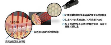 祛斑同时启动修复机制