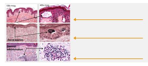 不伤害正常组织
