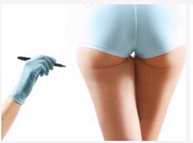 上海美莱腿部吸脂价格