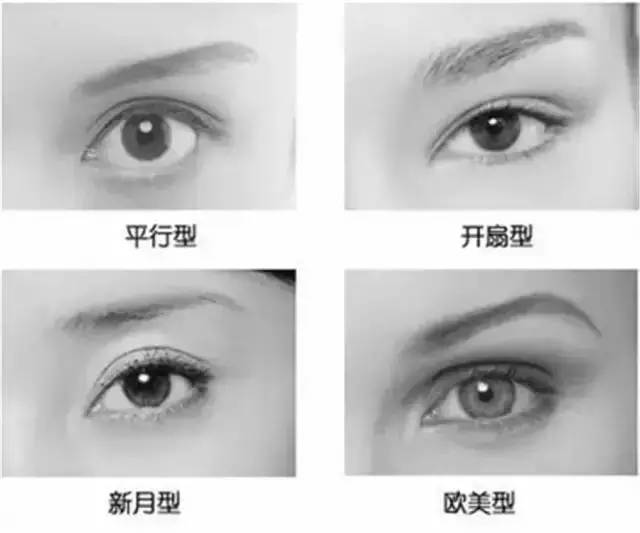 双眼皮类型