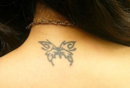 激光洗纹身留疤吗