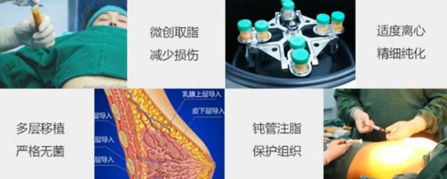 美莱·自体脂肪培养技术