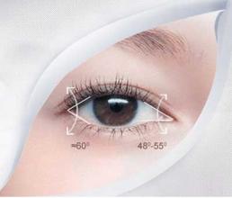 上海双眼皮整形手术需要多少钱