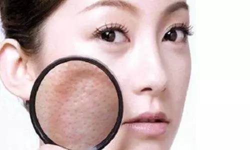 肌肤老化导致毛孔粗大
