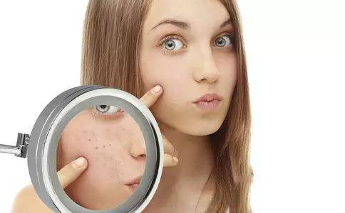 角质层过厚导致毛孔粗大