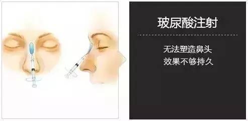 上海美莱注射隆鼻整形
