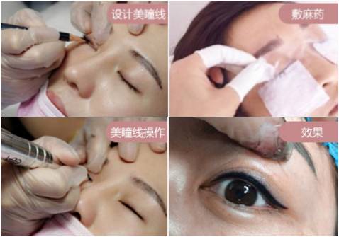 美莱纹眼线