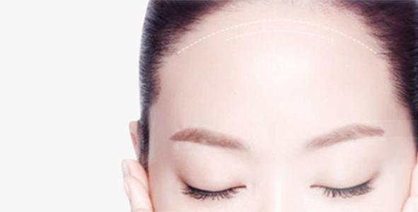 上海美莱丰额头