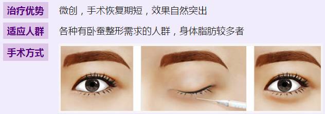 自体脂肪填充卧蚕