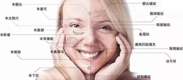 上海美莱自体脂肪填充