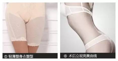 美莱多维立体吸脂