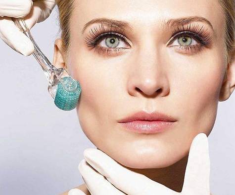 上海美莱微针美塑修复血管扩张