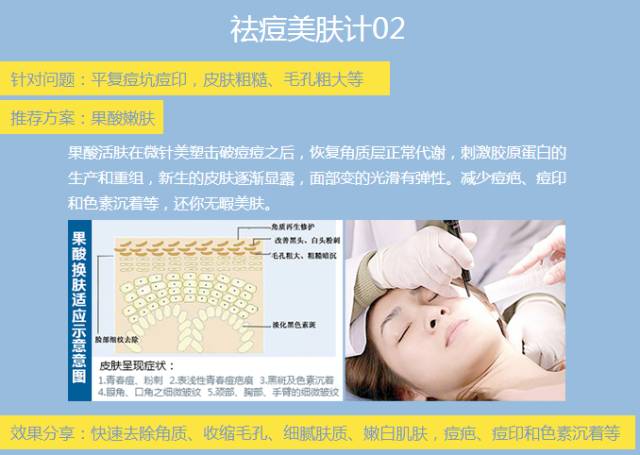 上海美莱祛痘过程