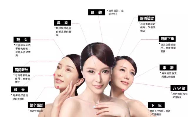 上海美莱玻尿酸填充