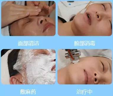 上海美莱激光射频