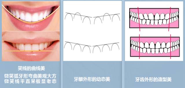牙齿矫正三美