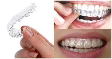 上海美莱隐形牙齿矫正