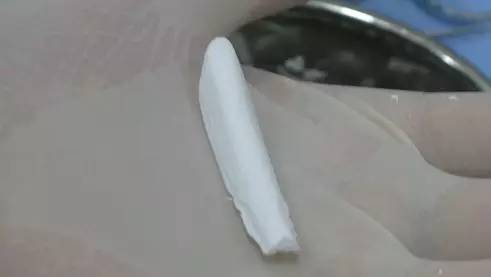 上海美莱膨体隆鼻整形