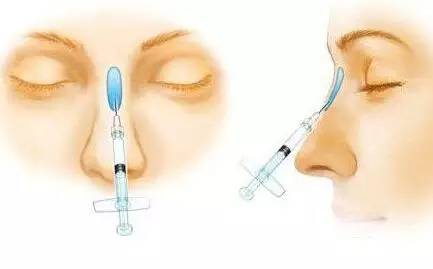 上海美莱注射隆鼻整形