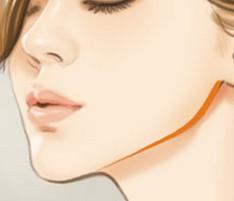 上海美莱注射丰下巴